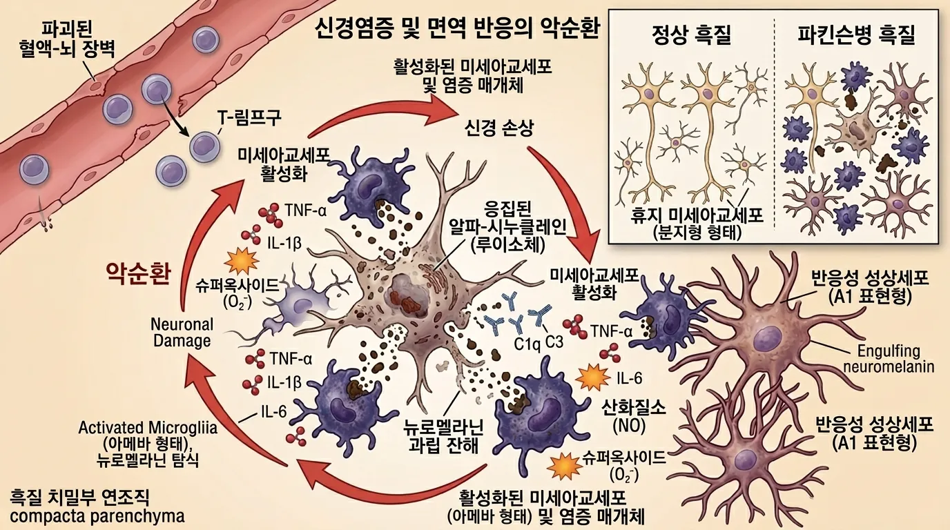 신경염증 및 면역 반응의 악순환