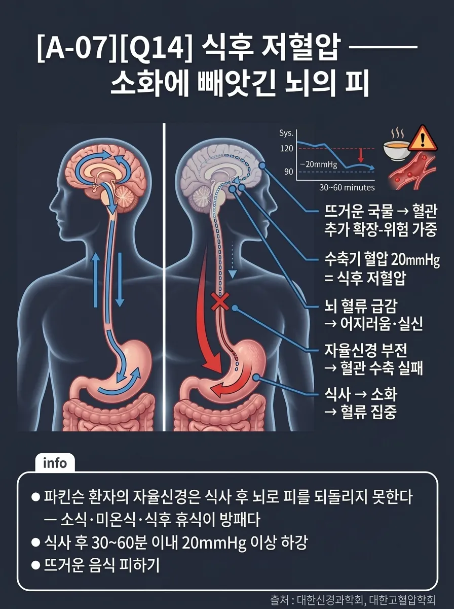 식후 저혈압 — 소화에 빼앗긴 뇌의 피
