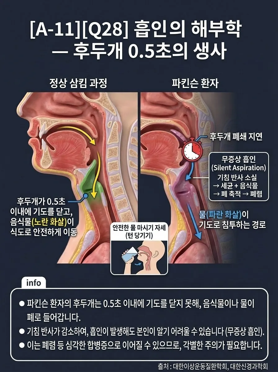 흡인의 해부학 — 후두개 0.5초의 생사