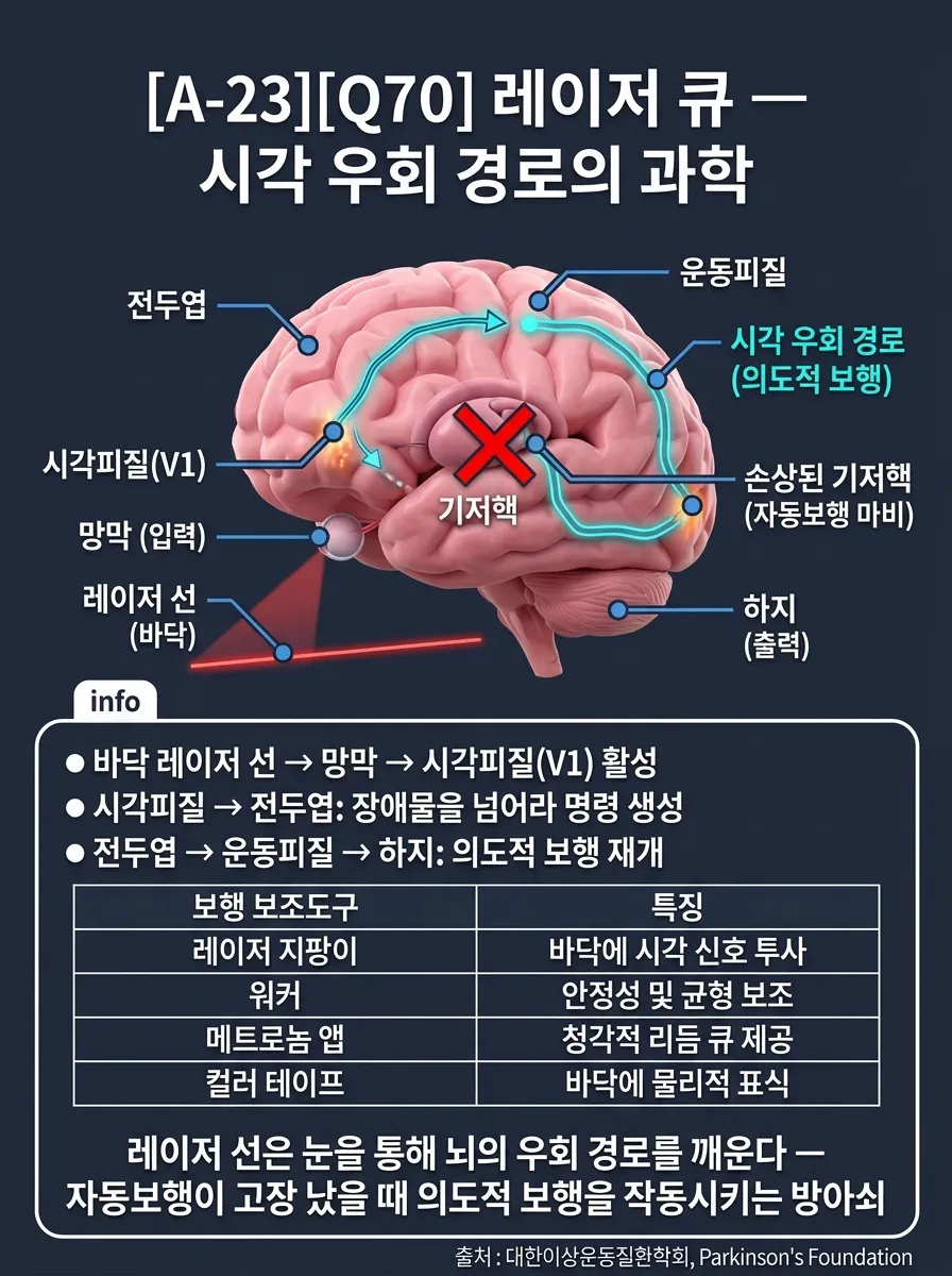 레이저 큐 — 시각 우회 경로의 과학
