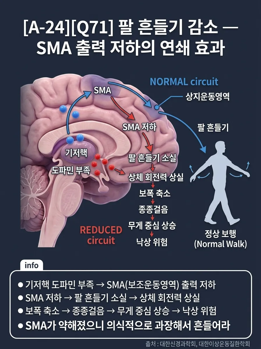 팔 흔들기 감소 — SMA 출력 저하의 연쇄 효과
