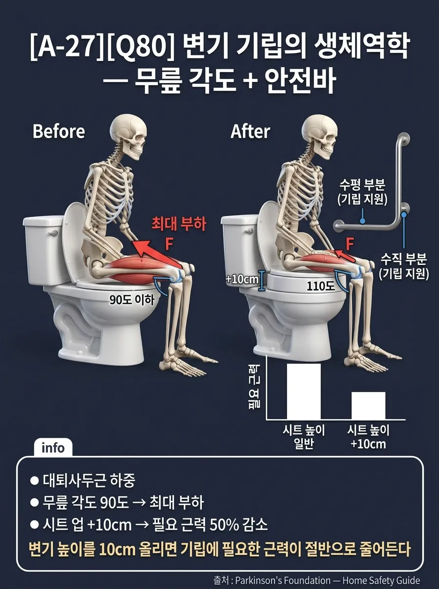 변기 기립의 생체역학 — 무릎 각도 + 안전바