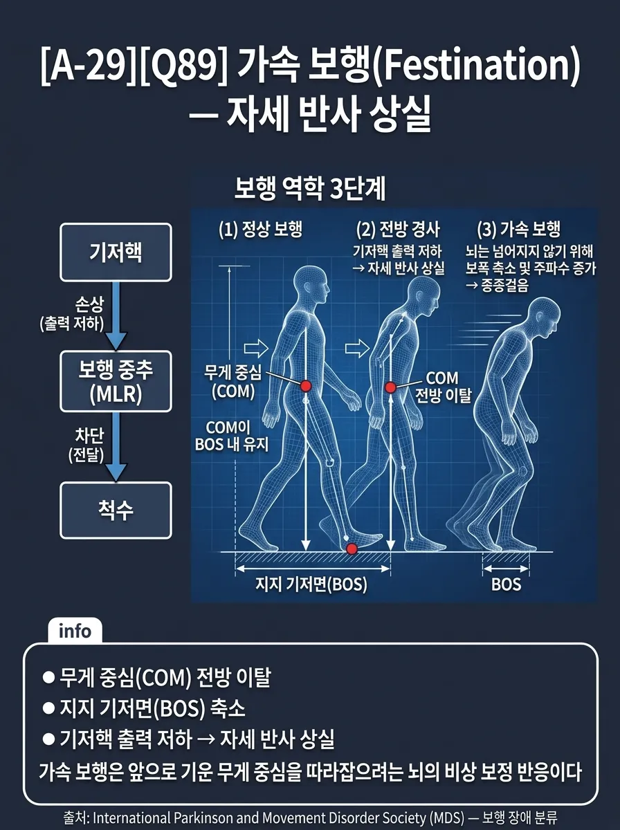 가속 보행(Festination) — 자세 반사 상실의 역학