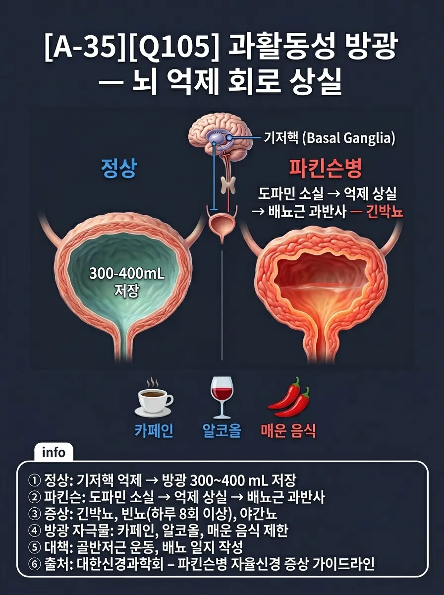 과활동성 방광 — 뇌 억제 회로 상실