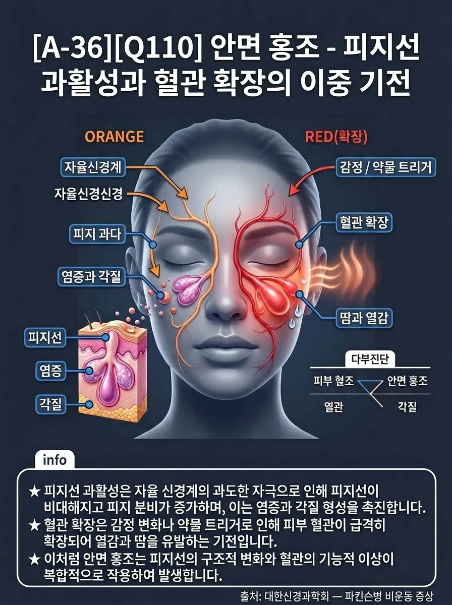 안면 홍조 — 피지선 과활성과 혈관 확장의 이중 기전