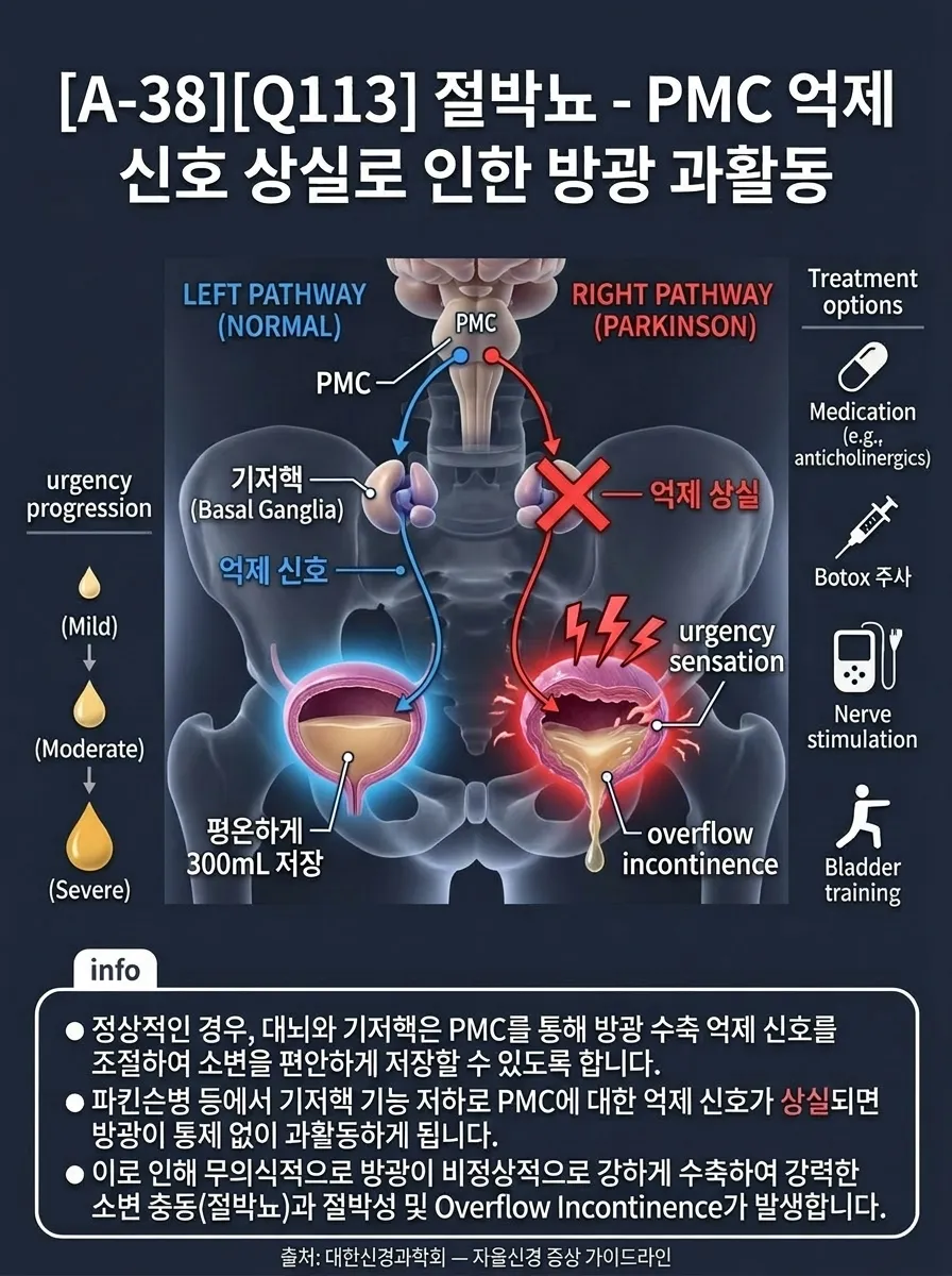 절박뇨 — PMC 억제 신호 상실로 인한 방광 과활동