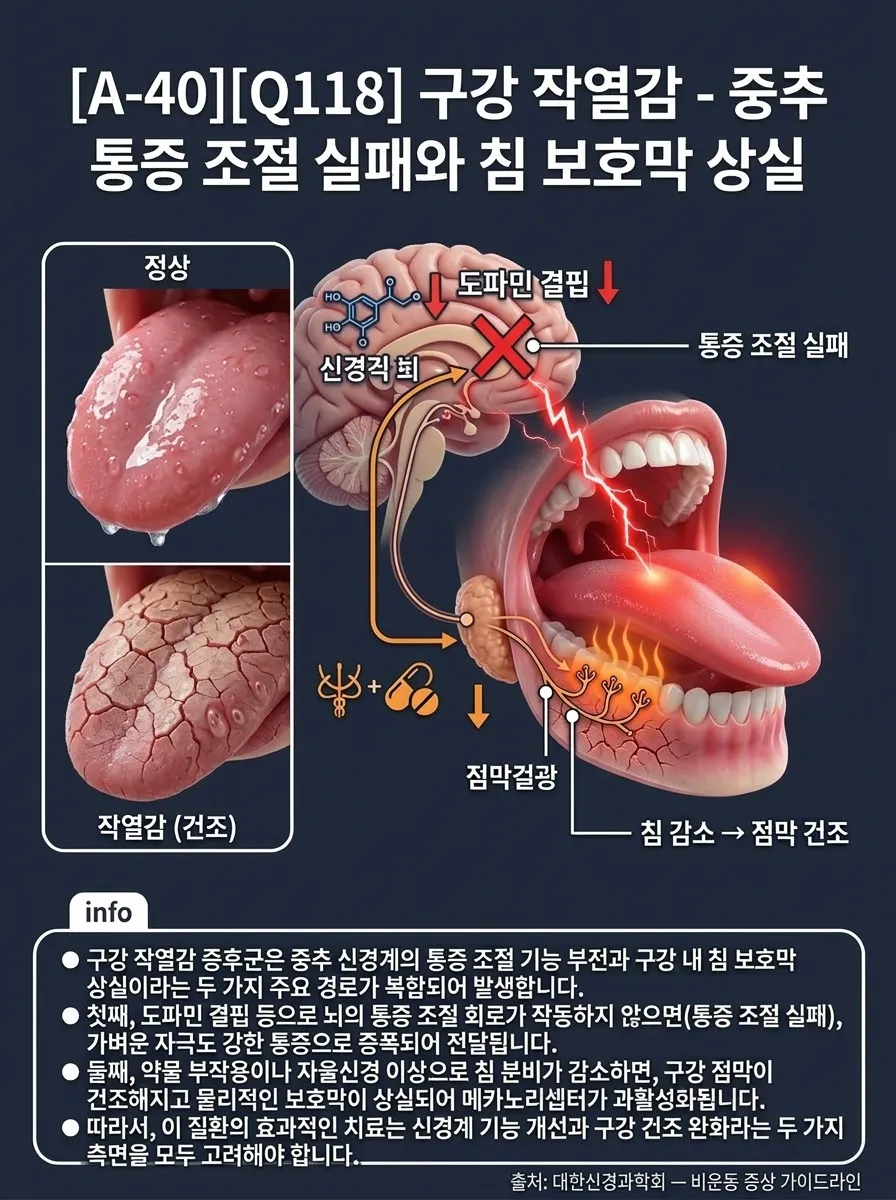 구강 작열감 — 중추 통증 조절 실패와 침 보호막 상실