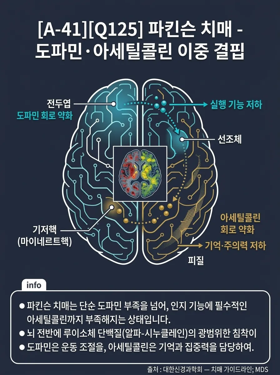 파킨슨 치매(PDD) — 도파민+아세틸콜린 이중 결핍