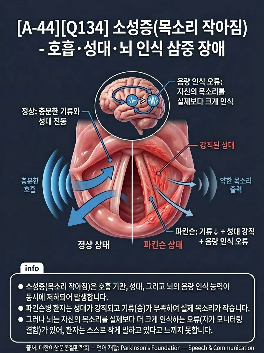 소성증(목소리 작아짐) — 호흡·성대·뇌 인식 삼중 장애