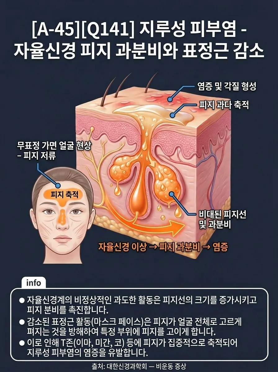 지루성 피부염 — 자율신경 피지 과분비와 표정근 감소