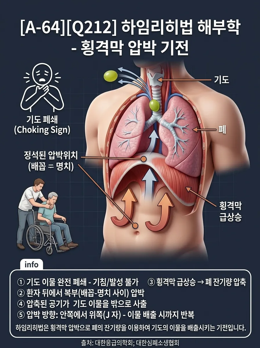 하임리히법 해부학 — 횡격막 압박 기전