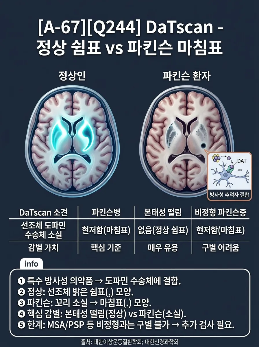 DaTscan — 정상 쉼표 vs 파킨슨 마침표