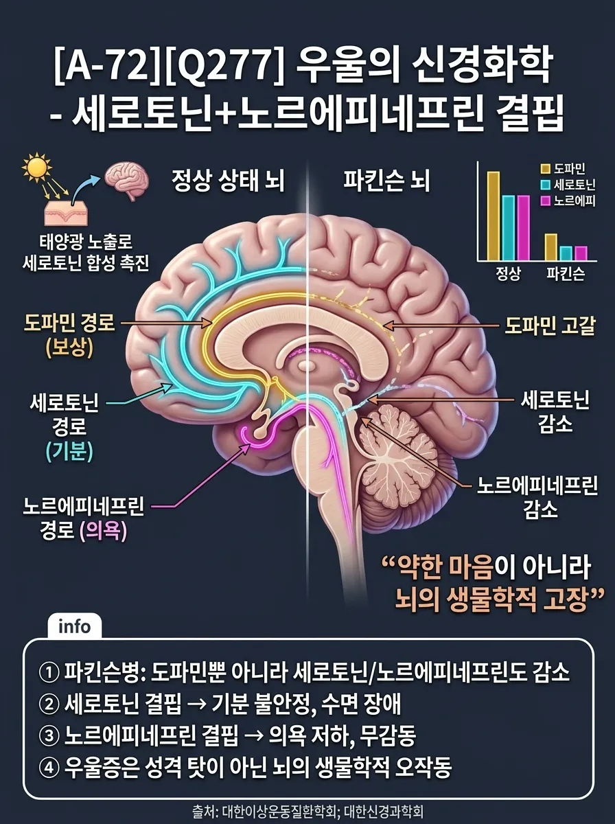 우울의 신경화학 — 세로토닌+노르에피네프린 결핍