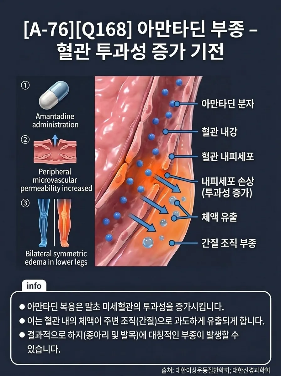 아만타딘 부종 — 혈관 투과성 증가 기전
