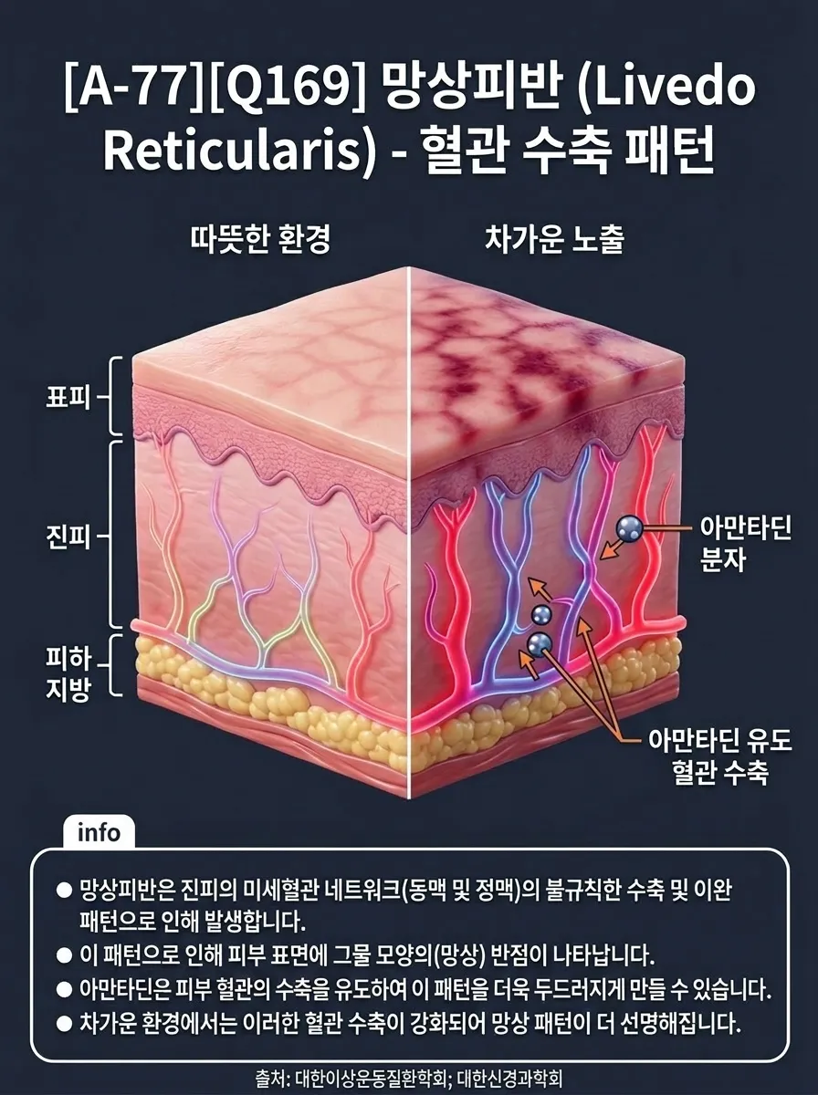 아만타딘 망상피반(Livedo Reticularis) — 혈관 수축 패턴