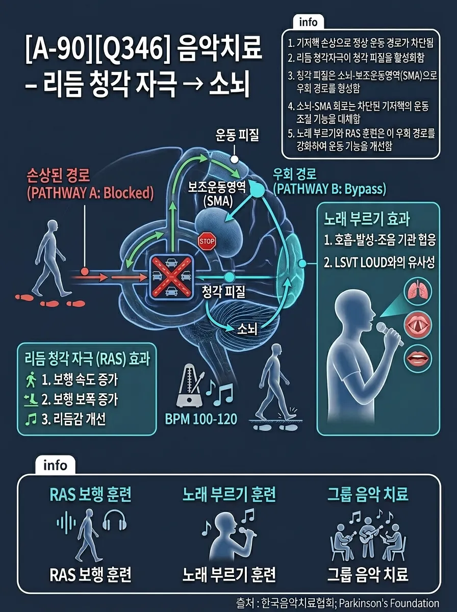 음악 치료 — 리듬 청각 자극(RAS) → 소뇌 우회