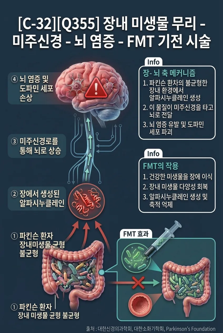 장내 미생물 무리/미주신경/뇌 염증/FMT 기전